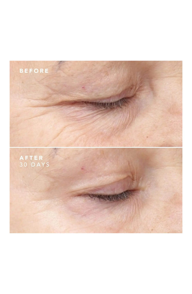 BIOEFFECT 30 Days Treatment