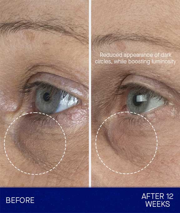 Augustinus Bader THE EYE CREAM