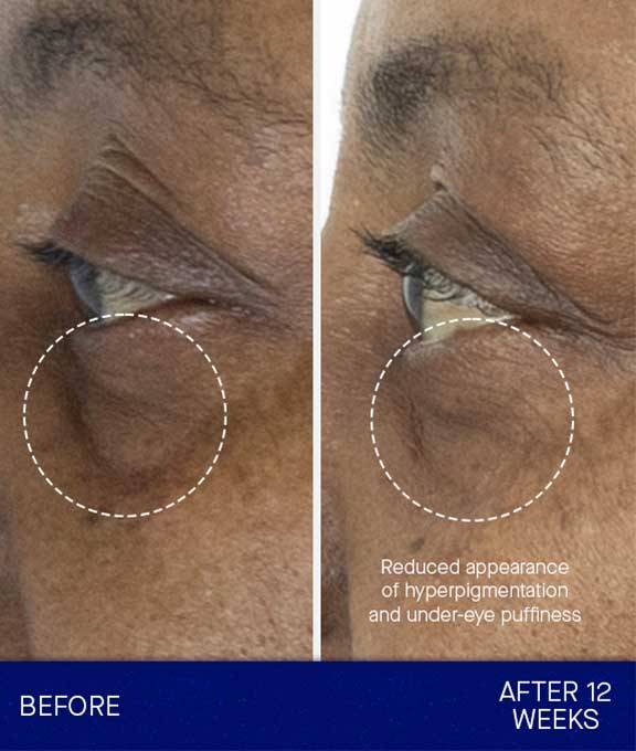 Augustinus Bader THE EYE CREAM