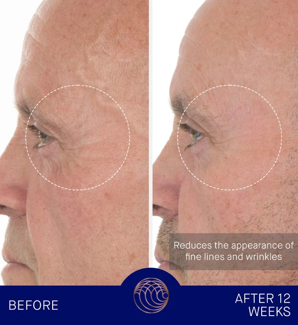 AUGUSTINUS BADER The Retinol Serum